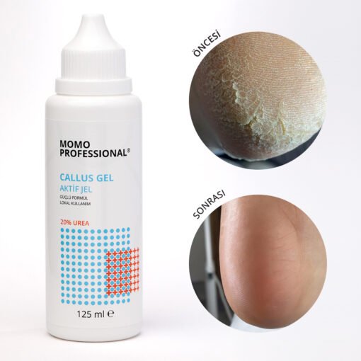 Callus Gel, Nasır Sökücü Jel, Pedikür için Keratolitik, 125 ml - Görsel 2